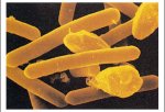 Vibrio cholerae